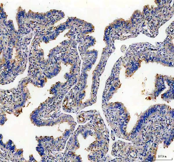 a13661 1 stoml3 primary antibodies ihc testing 1