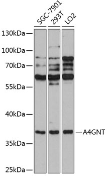 Western blot analysis of extracts of various cell lines, using A4GNT antibody  at 1:1000 dilution