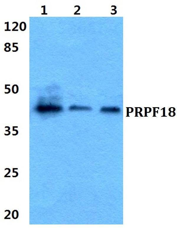 Western blot (WB) analysis of PRPF18 polyclonal antibody at 1:500 dilution
Lane1:HEK29T cell lysate
Lane2:sp2/0 cell lysate
Lane3:H9C2 cell lysate