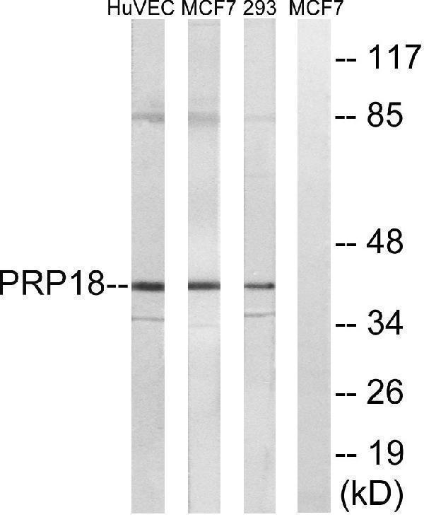 Western blot analysis of lysates from 293, MCF-7, and HUVEC cells, using PRPF18 Antibody