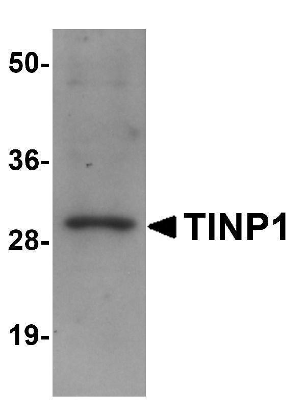 a13677 nsa2 primary antibodies wb testing 1