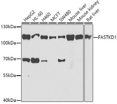 Western blot analysis of extracts of various cell lines, using FASTKD1 antibody  at 1:1000 dilution