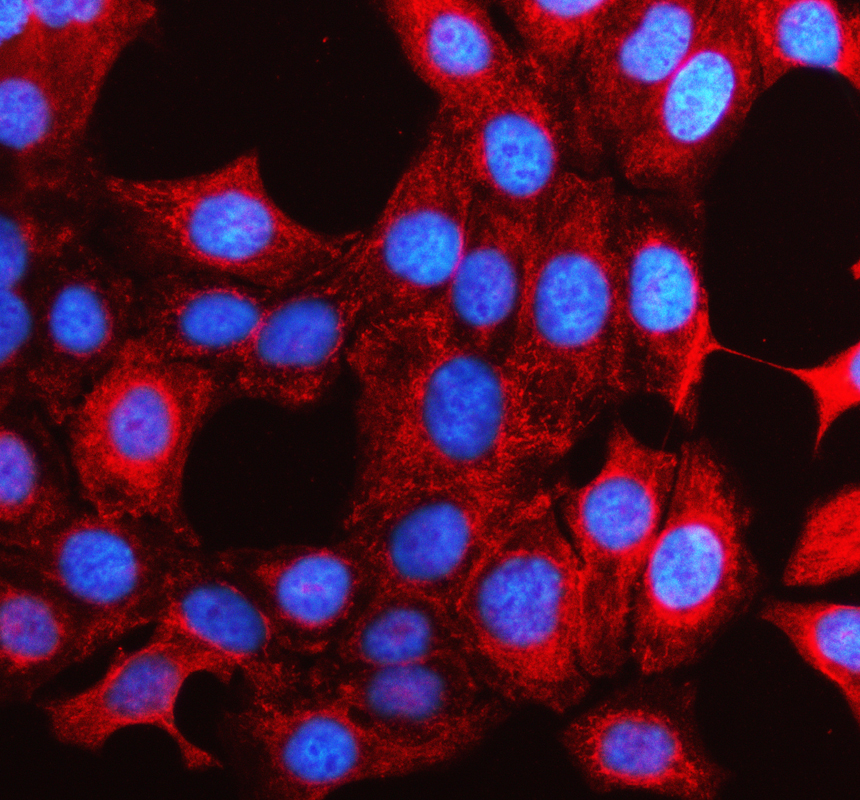 a13699 1 krt79 primary antibodies if testing 1