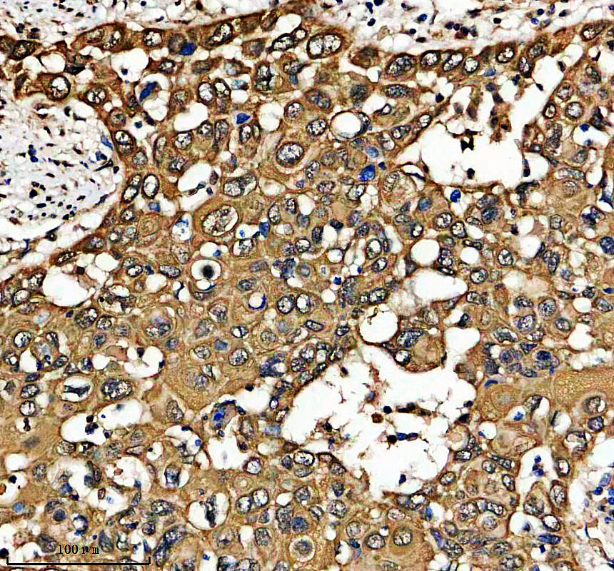 IHC analysis of KRT79 using anti-KRT79 antibody (A13699-1)