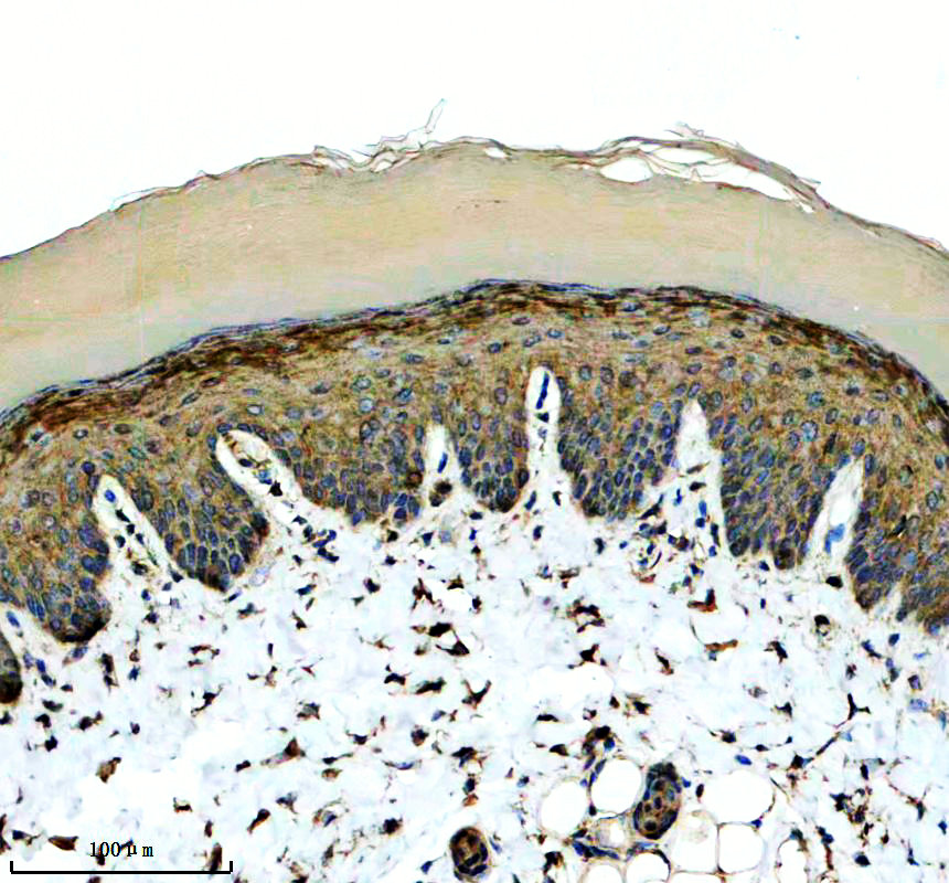 IHC analysis of KRT79 using anti-KRT79 antibody (A13699-1)