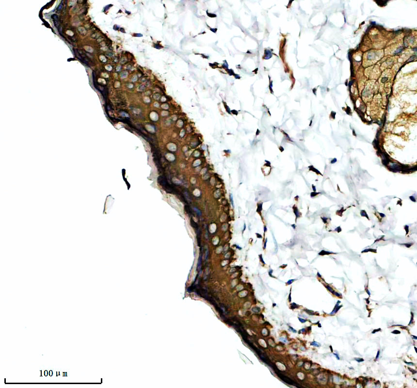 a13699 1 krt79 primary antibodies ihc testing 3