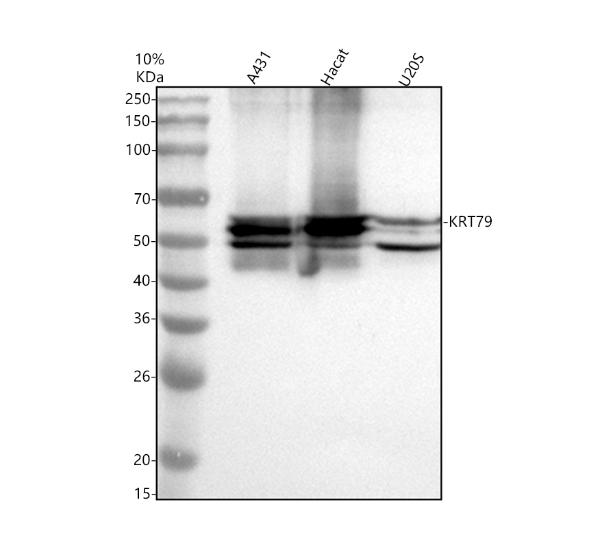 Western blot analysis of KRT79 using anti-KRT79 antibody (A13699-1)