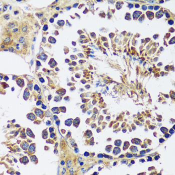 Immunohistochemistry of paraffin-embedded mouse testis using CCDC124 antibody  at dilution of 1:100 