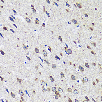 Immunohistochemistry of paraffin-embedded mouse brain using CCDC124 antibody  at dilution of 1:100 