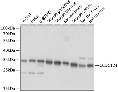 Western blot analysis of extracts of various cell lines, using CCDC124 antibody  at 1:1000 dilution