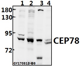 a13706 1 cep78 primary antiboties wb testing 1