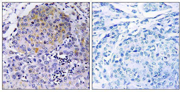 a13706 cep78 primary antibodies ihc testing 1