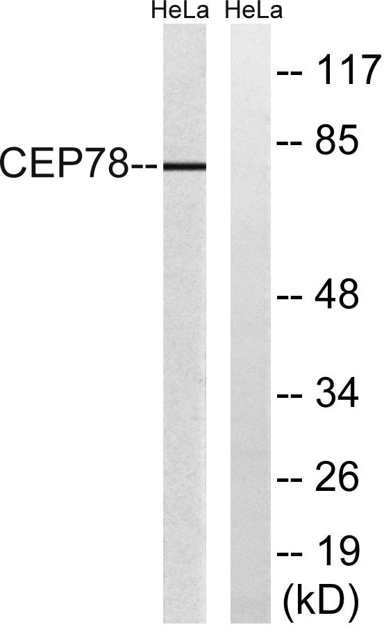 a13706 cep78 primary antibodies wb testing 3