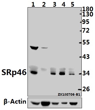 Western blot (WB) analysis of SRp46 (E72) pAb at 1:500 dilution
Lane1:PC12 whole cell lysate(40ug)
Lane2:The Embryo tissue lysate of Mouse(40ug)
Lane3:EC9706 whole cell lysate(20ug)
Lane4:HEK293T whole cell lysate(10ug)
Lane5:A549 whole cell lysate(20ug)