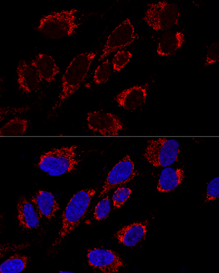 Confocal immunofluorescence analysis of U2OS cells using MRPS31 Polyclonal Antibody  at dilution of 1:200