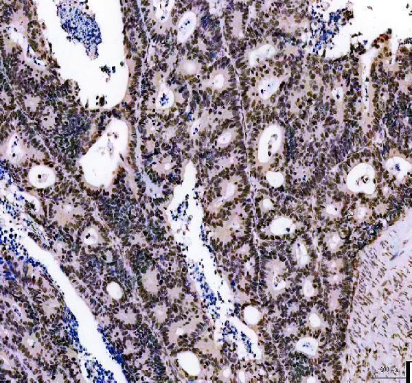 IHC analysis of DNAJB5 using anti-DNAJB5 antibody (A13716-1)