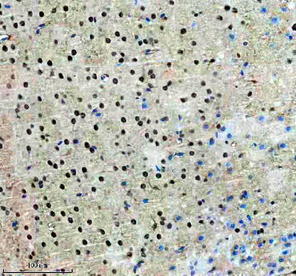 IHC analysis of DNAJB5 using anti-DNAJB5 antibody (A13716-1)
