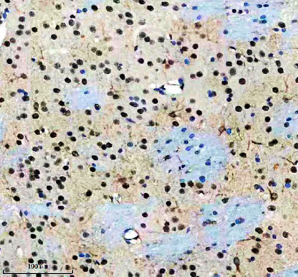 a13716 1 dnajb5 primary antibodies ihc testing 3
