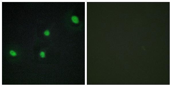 a13717 1 cdca4 primary antibodies if testing 1