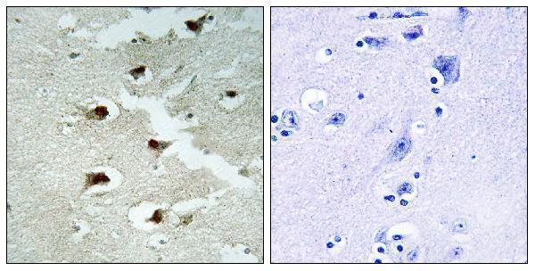 a13717 1 cdca4 primary antibodies ihc testing 2
