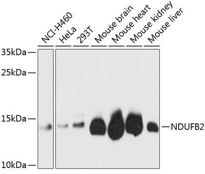 a13719 ndufb2 primary antiboties wb testing 1