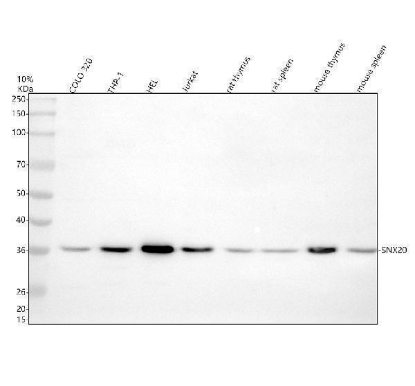 Western blot analysis of SNX20 using anti-SNX20 antibody (A13724-1)