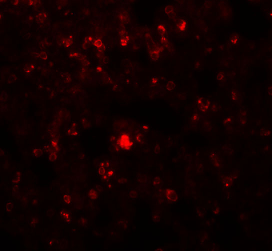 Immunofluorescence of RHBDD2 in Rat Lung cells with RHBDD2 antibody at 20 μg/mL