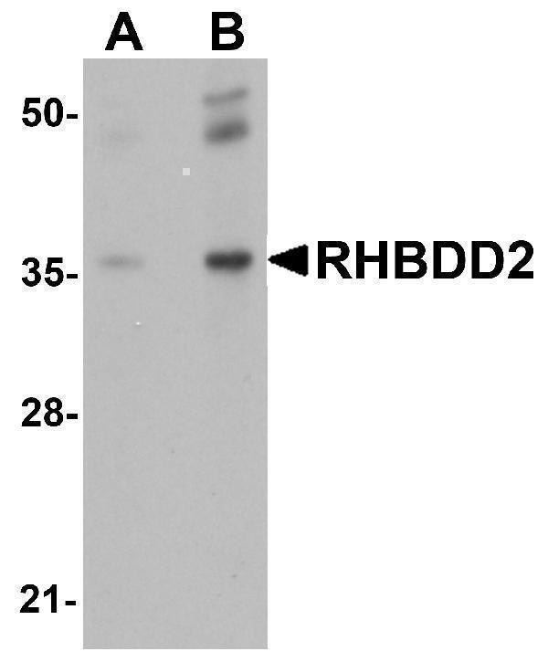 Western blot analysis of RHBDD2 in rat lung tissue lysate with RHBDD2 antibody at (A) 1 and (B) 2 μg/mL