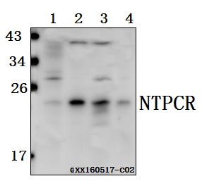 Western blot (WB) analysis of NTPCR polyclonal antibody at 1:500 dilution
Lane1:HCT116 whole cell lysate(40ug)
Lane2:HCC827 whole cell lysate(40ug)
Lane3:L02 whole cell lysate(40ug)
Lane4:SK-OVCAR3 whole cell lysate(40ug)