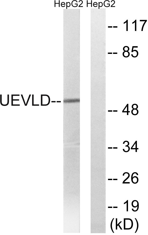 Western blot analysis of lysates from HepG2 cells, using UEVLD Antibody