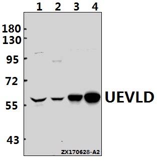 Western blot (WB) analysis of UEVLD polyclonal antibody at 1:500 dilution
Lane1:Hela whole cell lysate(40ug)
Lane2:Jurkat whole cell lysate(40ug)
Lane3:H9C2 whole cell lysate(20ug)
Lane4:AML-12 whole cell lysate(20ug)