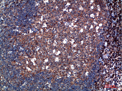 Immunohistochemical analysis of paraffin-embedded human-tonsil, antibody was diluted at 1:200