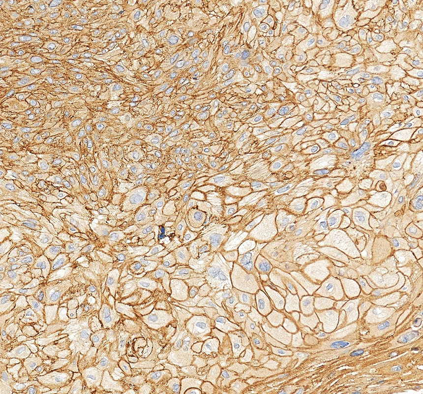 IHC analysis of LRRCC1 using anti-LRRCC1 antibody (A13749)