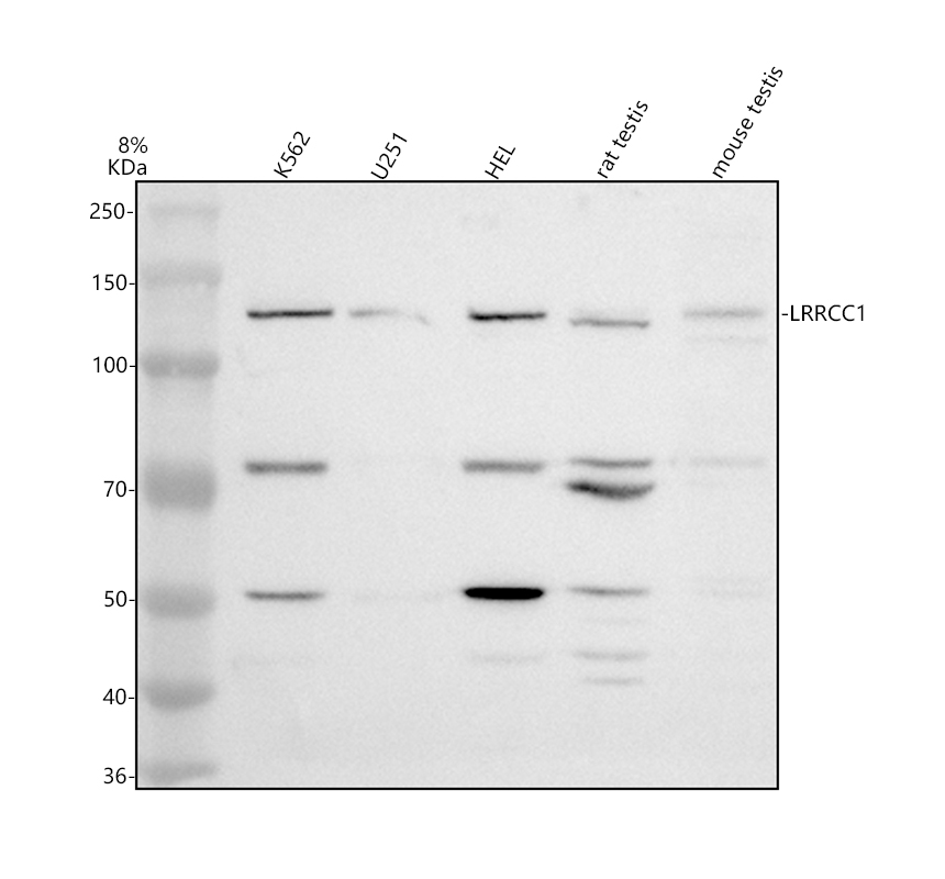 Western blot analysis of LRRCC1 using anti-LRRCC1 antibody (A13749)