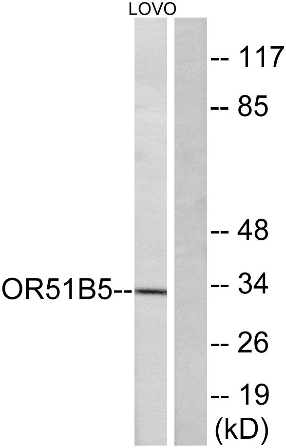 a13766 or51b5 primary antibodies wb testing 2