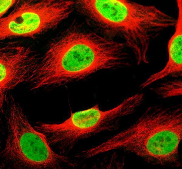 IF analysis of THYN1 using anti-THYN1 antibody (A13785-1) and anti-Alpha Tubulin antibody (M03989-3)