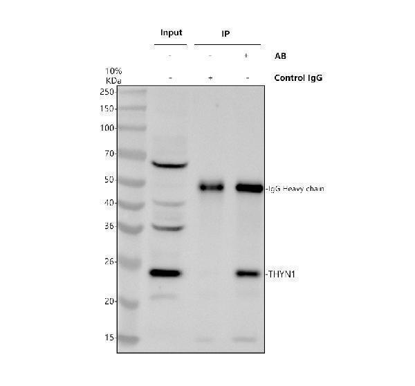 Immunoprecipitating THYN1 in Hela whole cell lysate