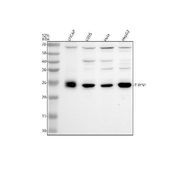 Western blot analysis of THYN1 using anti-THYN1 antibody (A13785-1)