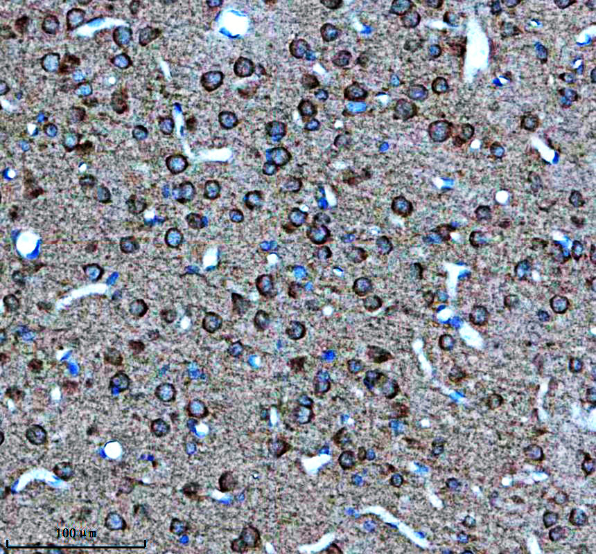a13788 1 lsm12 primary antibodies ihc testing 3