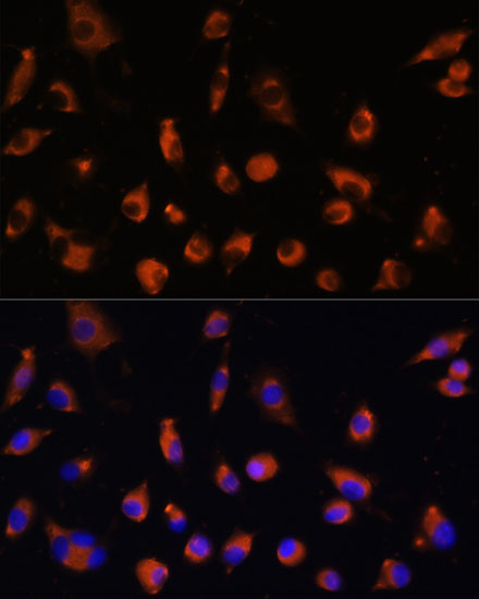 a13805 tmem25 primary antiboties if testing 2