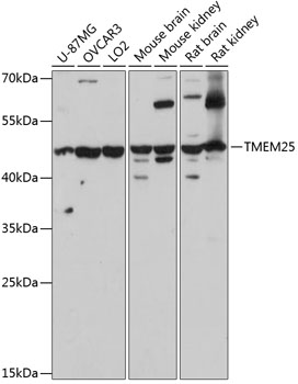 a13805 tmem25 primary antiboties wb testing 1