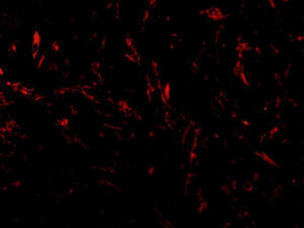 a13808 ttc5 primary antibodies if testing 3