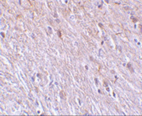 a13808 ttc5 primary antibodies ihc testing 2