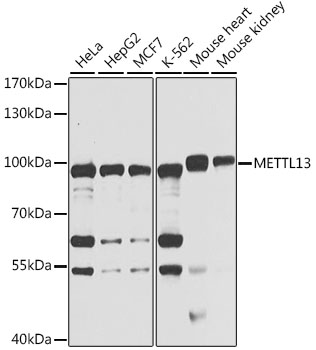 a13818 mettl13 primary antiboties wb testing 1