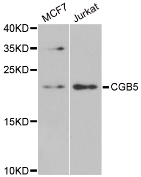 Western blot analysis of extracts of various cell lines, using CGB5 antibody at 1:1000 dilution