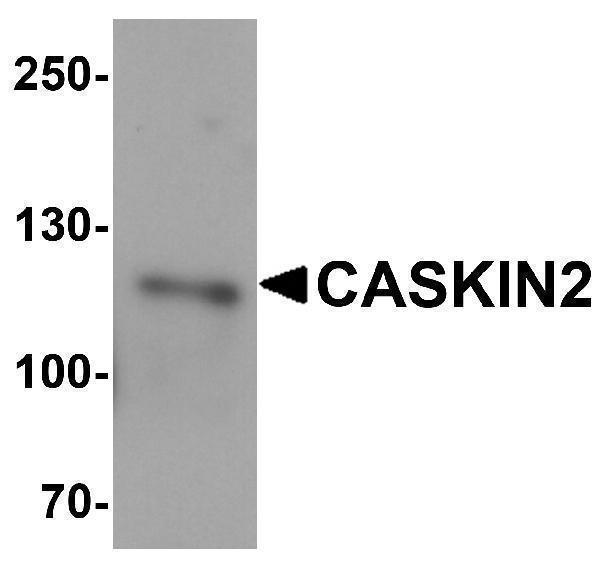 a13821 caskin2 primary antibodies wb testing 1