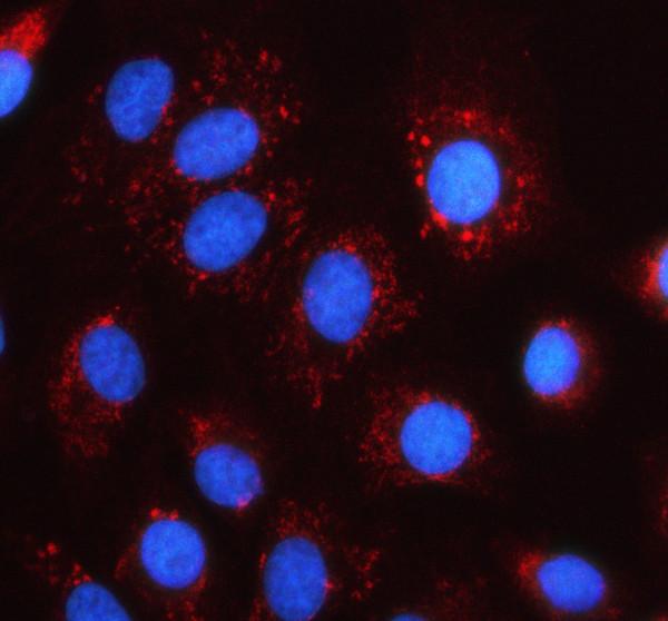 a13823 2 mrps35 primary antibodies if testing 1