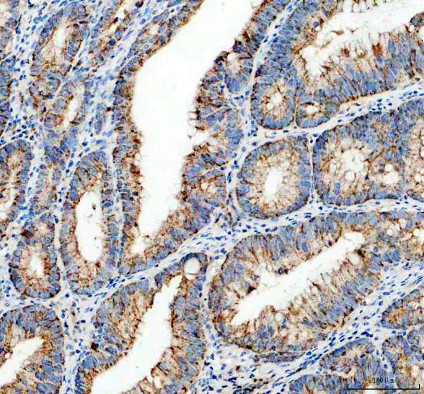 IHC analysis of MRPS35 using anti-MRPS35 antibody (A13823-2)