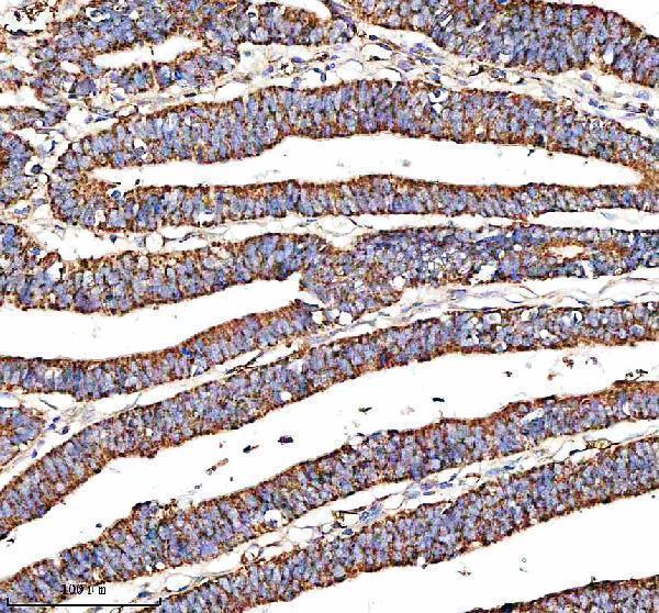  IHC analysis of MRPS35 using anti-MRPS35 antibody (A13823-2)