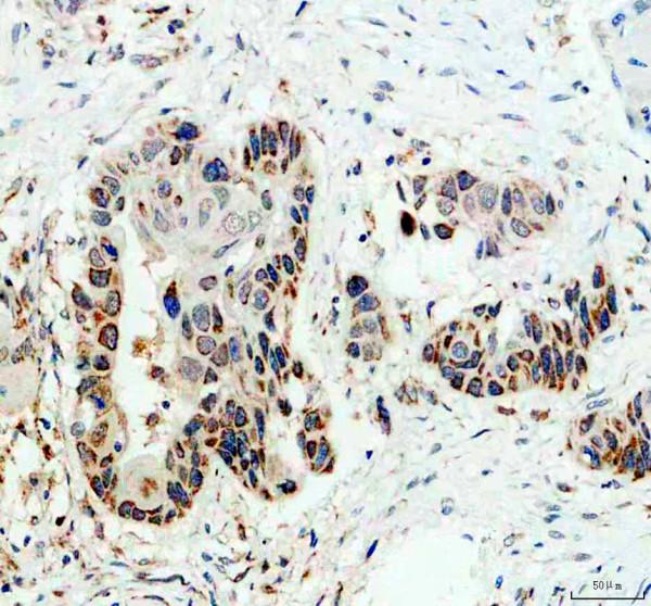 IHC analysis of MRPS35 using anti-MRPS35 antibody (A13823-2)